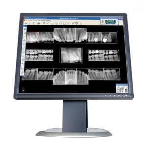 Digital Dental X-Ray